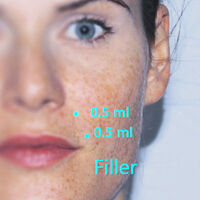 Imagen del cutis de una mujer con unos puntos de control de la herramienta Proposer