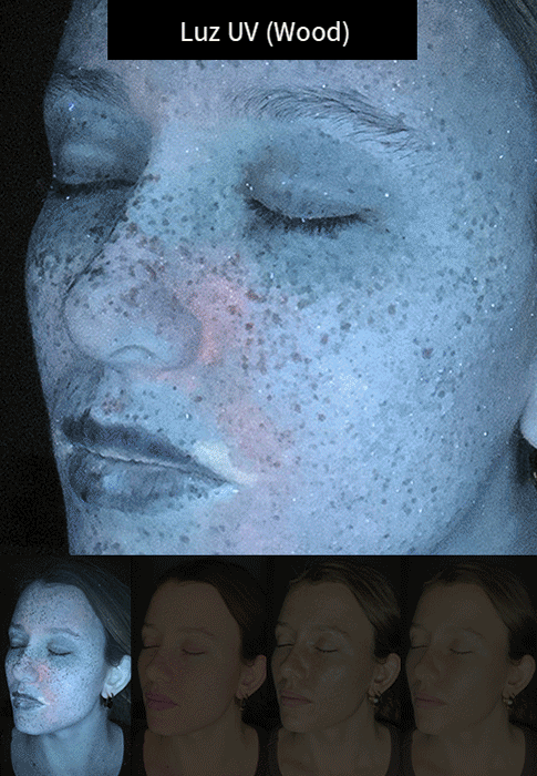 Imagen animada sobre las 4 luces disponible el dispositivo portátil para fotos de dermatología y estética